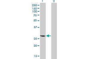 Western Blot analysis of RBCK1 expression in transfected 293T cell line by RBCK1 MaxPab polyclonal antibody. (RBCK1 anticorps  (AA 1-230))