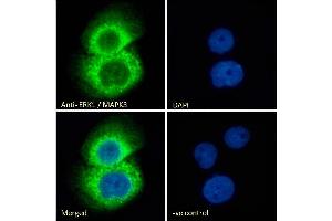 ABIN185399 Immunofluorescence analysis of paraformaldehyde fixed A431 cells, permeabilized with 0.