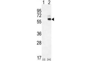 Western Blotting (WB) image for anti-Kininogen 1 (KNG1) antibody (ABIN2996315) (KNG1 anticorps)