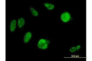Immunofluorescence of purified MaxPab antibody to IRX2 on HeLa cell. (IRX2 anticorps  (AA 1-471))