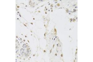 Immunohistochemistry of paraffin-embedded human breast using USP7 Antibody (ABIN5971305) at dilution of 1/100 (40x lens). (USP7 anticorps)