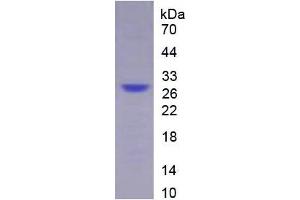 SDS-PAGE (SDS) image for Apolipoprotein A-IV (APOA4) ELISA Kit (ABIN6574298)
