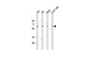 All lanes : Anti-YY1 Antibody (Center) at 1:500-1:1000 dilution Lane 1: 293 whole cell lysate Lane 2: C6 whole cell lysate Lane 3: Hela whole cell lysate Lane 4: U-251 MG whole cell lysate Lysates/proteins at 20 μg per lane. (YY1 anticorps)