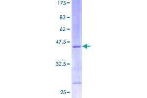 Image no. 1 for Ribosomal Protein S13 (RPS13) (AA 1-151) protein (GST tag) (ABIN1318730)
