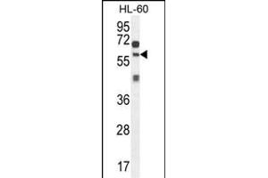 ZSWIM1 Antibody (C-term) (ABIN654558 and ABIN2844265) western blot analysis in HL-60 cell line lysates (35 μg/lane). (ZSWIM1 anticorps  (C-Term))