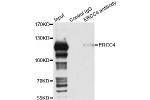 Immunoprecipitation analysis of 150ug extracts of 293T cells using 3ug ERCC4 antibody. (ERCC4 anticorps)
