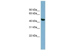 WB Suggested Anti-C22orf28 Antibody Titration: 0. (C22orf28 anticorps  (N-Term))
