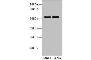 Western blot All lanes: TRIM17 antibody at 1 μg/mL Lane 1: U87 whole cell lysate Lane 2: K562 whole cell lysate Secondary Goat polyclonal to rabbit IgG at 1/10000 dilution Predicted band size: 55, 40 kDa Observed band size: 55 kDa (TRIM17 / RNF16 anticorps  (AA 1-300))