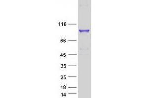 Validation with Western Blot