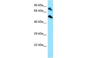 WB Suggested Anti-TOP1MT Antibody Titration: 1. (TOP1MT anticorps  (C-Term))