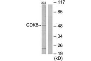 Western blot analysis of extracts from 293 cells, using CDK8 Antibody. (CDK8 anticorps  (AA 1-50))