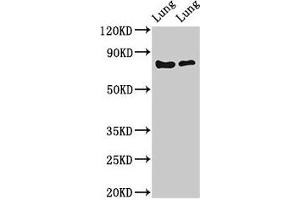 Western Blot Positive WB detected in: Rat lung tissue, Mouse lung tissue All lanes: FOXP1 antibody at 2 μg/mL Secondary Goat polyclonal to rabbit IgG at 1/50000 dilution Predicted band size: 76, 55, 66, 75, 13, 67, 78 kDa Observed band size: 76 kDa (FOXP1 anticorps  (AA 541-677))