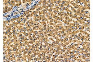 ABIN6261717 and ABIN6278027 at 1/100 staining Rat liver tissue by IHC-P. (FGA anticorps  (C-Term))