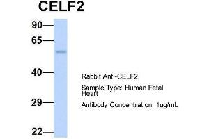 Host:  Rabbit  Target Name:  CELF2  Sample Type:  Human Fetal Heart  Antibody Dilution:  1.