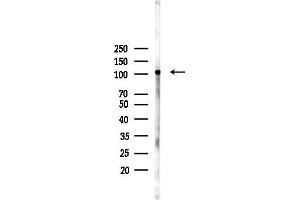 Western blot analysis of lysates from Hela cells(heat-shock,45 min treatment), using Phospho-eEF2k (Ser366) Antibody at 1/1000 dilution.