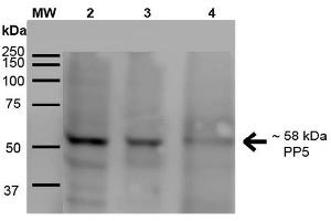 Western Blot analysis of Human A431, HEK293, and Jurkat cell lysates showing detection of ~58 kDa PP5 protein using Mouse Anti-PP5 Monoclonal Antibody, Clone 2E11 . (PP5 anticorps  (Alkaline Phosphatase (AP)))
