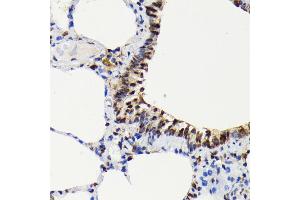 Immunohistochemistry of paraffin-embedded rat lung using Phospho-ERK1-T202 + ERK2-T185 antibody (ABIN7268610) at dilution of 1:100 (40x lens). (ERK1/2 anticorps  (pThr185, pThr202))