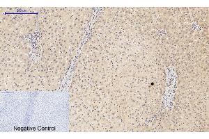 Immunohistochemical analysis of paraffin-embedded human liver tissue.