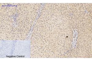 Immunohistochemical analysis of paraffin-embedded human liver tissue. (PIK3R1 anticorps  (pTyr607))