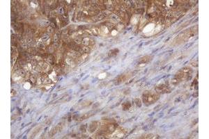 Image no. 1 for anti-COP9 Signalosome Complex Subunit 6 (COPS6) (AA 58-327) antibody (ABIN1491602)