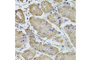 Immunohistochemistry of paraffin-embedded human stomach using PTCD3 antibody. (PTCD3 anticorps  (AA 450-689))