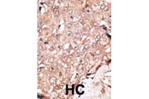 Immunohistochemistry (IHC) image for anti-Lysine (K)-Specific Demethylase 1A (KDM1A) antibody (ABIN2996581) (LSD1 anticorps)