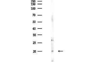 Western blot analysis of lysates from PC12 cells(LPS 4h treatment), using Phospho-Stathmin 1 (Ser63) Antibody at 1/1000 dilution.
