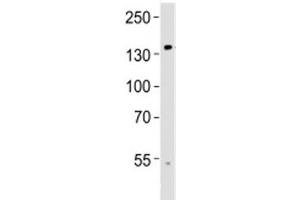 Western blot analysis of lysate from human brain tissue using TRPM8 antibody at 1:1000.