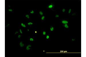 Immunofluorescence of monoclonal antibody to CHEK2 on HeLa cell. (CHEK2 anticorps  (AA 1-543))