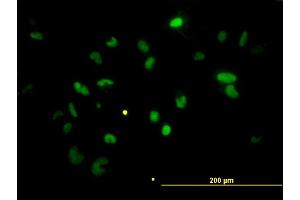 Immunofluorescence of monoclonal antibody to CHEK2 on HeLa cell.