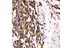 Immunohistochemistry of paraffin-embedded human esophagus using HCLS1 antibody (ABIN3023093, ABIN3023094, ABIN3023095 and ABIN6219386) at dilution of 1:100 (40x lens).