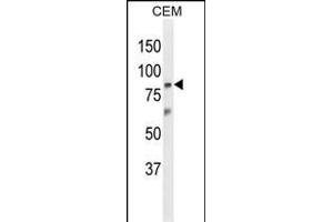 Western blot analysis of Z Antibody (N-term) (ABIN653866 and ABIN2843121) in CEM cell line lysates (35 μg/lane). (ZNF160 anticorps  (N-Term))
