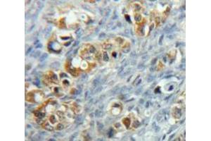 Used in DAB staining on fromalin fixed paraffin-embedded Ovary tissue (MCL-1 anticorps  (AA 6-328))