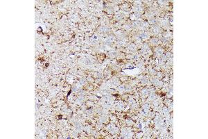 Immunohistochemistry of paraffin-embedded mouse brain using CNTN1 antibody (ABIN7266492) at dilution of 1:100 (40x lens).