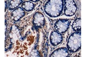 Detection of PKCe in Human Colon Tissue using Monoclonal Antibody to Protein Kinase C Epsilon (PKCe)