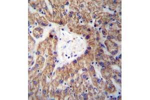 Immunohistochemistry analysis in formalin fixed and paraffin embedded human liver tissue reacted with GLYAT /  ACGNAT Antibody (Center) followed by peroxidase conjugation of the secondary antibody and DAB staining. (GLYAT anticorps  (Middle Region))