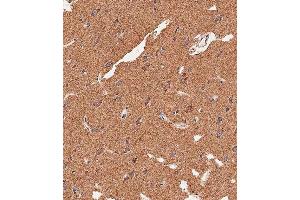 Immunohistochemical analysis of paraffin-embedded human brain tissue using (ABIN656416 and ABIN2845709) performed on the Leica® BOND RXm. (APG8b (AA 9-33), (N-Term) anticorps)