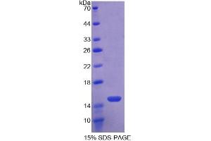 WB of Protein Standard: different control antibodies against Highly purified E.