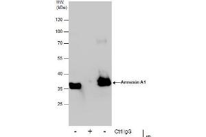 IP Image Immunoprecipitation of Annexin A1 protein from HeLa whole cell extracts using 5 μg of Annexin A1 antibody, Western blot analysis was performed using Annexin A1 antibody, EasyBlot anti-Rabbit IgG  was used as a secondary reagent.