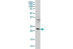 RAB9A monoclonal antibody (M01), clone 1E12 Western Blot analysis of RAB9A expression in HeLa . (RAB9A anticorps  (AA 17-115))