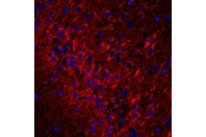 Immunofluorescent analysis of paraformaldehyde-fixed rat brain using,CD63 (ABIN7073400) at dilution of 1: 1500