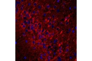 Immunofluorescent analysis of paraformaldehyde-fixed rat brain using,CD63 (ABIN7073400) at dilution of 1: 1500 (CD63 anticorps)