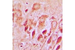Immunohistochemical analysis of Synphilin 1 staining in human brain formalin fixed paraffin embedded tissue section.