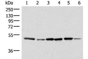 Western blot analysis of Jurkat PC-3 HepG2 Hela HT-29 and Raji cell lysates using IP6K1 Polyclonal Antibody at dilution of 1:400 (IP6K1 anticorps)