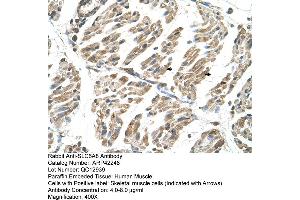 Rabbit Anti-SLC6A8 Antibody  Paraffin Embedded Tissue: Human Muscle Cellular Data: Skeletal muscle cells Antibody Concentration: 4. (SLC6A8 anticorps  (N-Term))