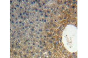 Used in DAB staining on fromalin fixed paraffin-embedded Liver tissue