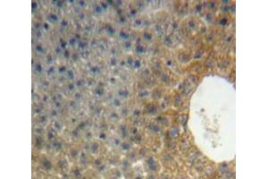 Used in DAB staining on fromalin fixed paraffin-embedded Liver tissue (APOH anticorps  (AA 20-297))