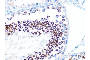Immunohistochemistry of paraffin-embedded rat testis using FMRP Rabbit mAb (ABIN1679778, ABIN3019025, ABIN3019026 and ABIN7101703) at dilution of 1:100 (40x lens). (FMR1 anticorps)