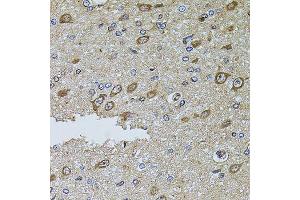 Immunohistochemistry of paraffin-embedded rat brain using MTIF3 antibody (ABIN5974622) at dilution of 1/100 (40x lens). (MTIF3 anticorps)