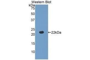 Detection of recombinant FBLN5 using Polyclonal Antibody to Fibulin 5 (FBLN5) (Fibulin 5 anticorps  (AA 277-448))